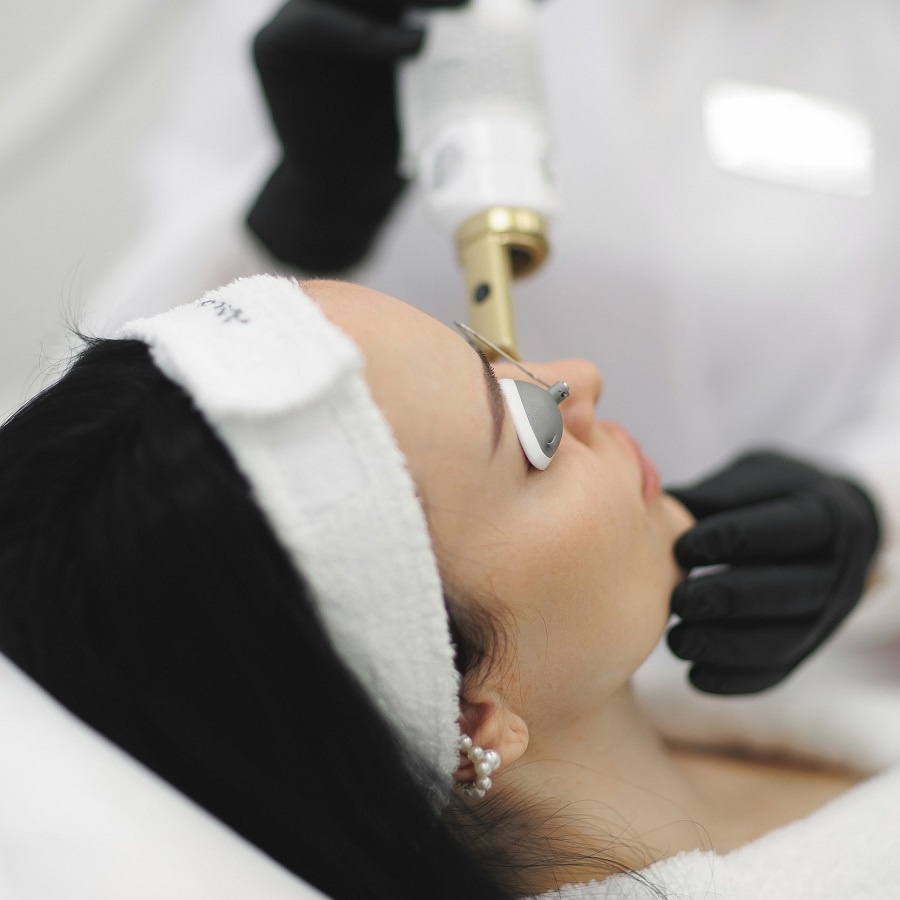 Лечение акне и постакне в Краснодаре