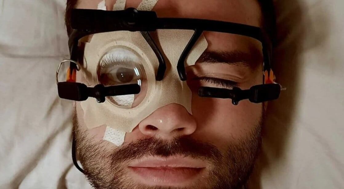    Во время исследования ученые фиксировали один глаз спящих людей. Источник: gizmodo.com