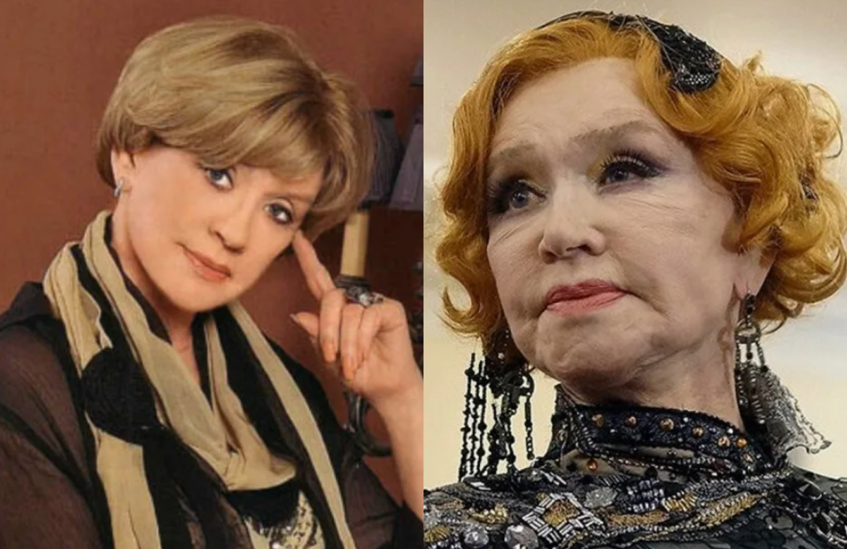 на фото Вера Алентова до и после пластики 