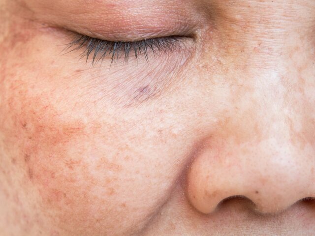    Фото: 123RF/srisakorn