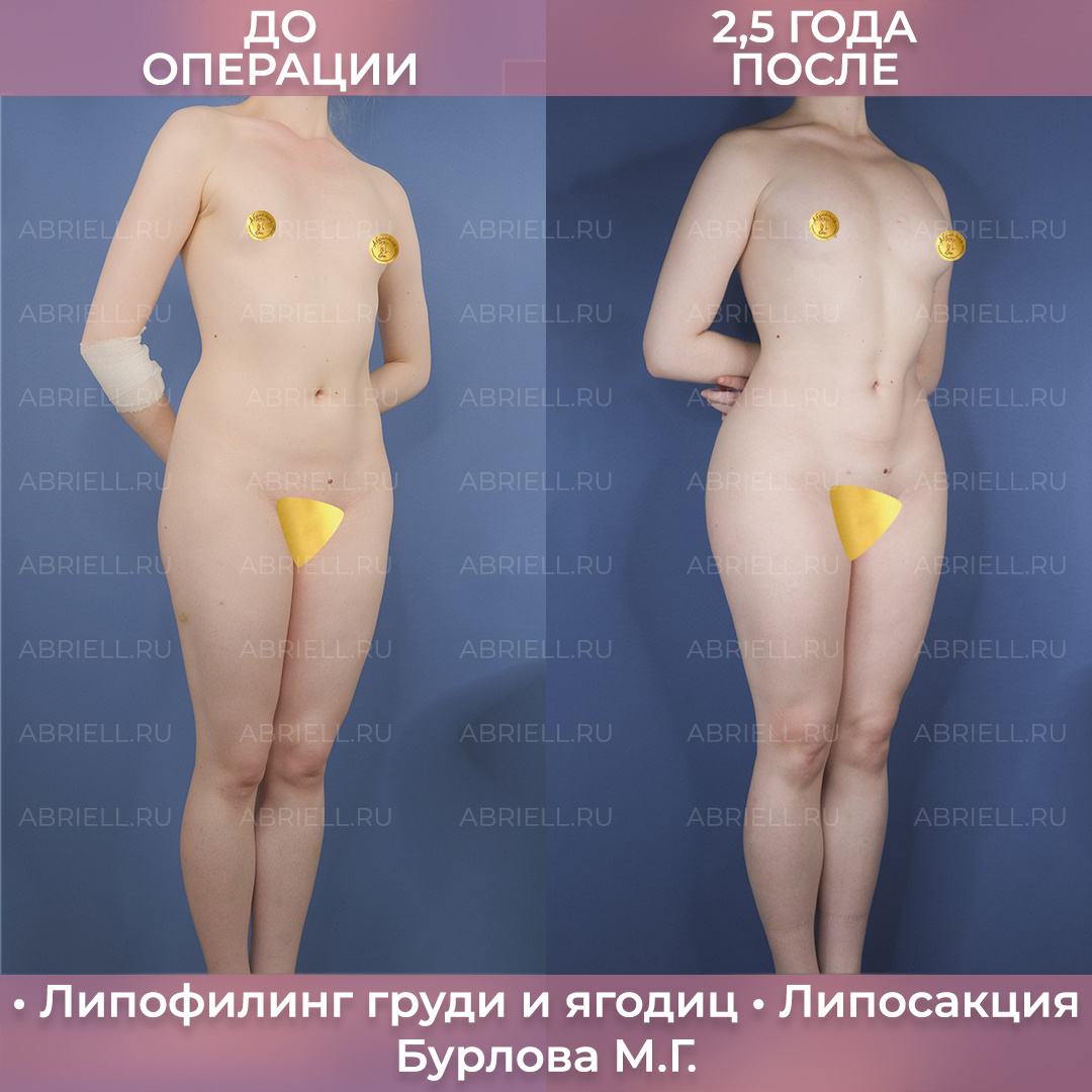 Хирург Бурлова (Левицкая) Мария Григорьевна 