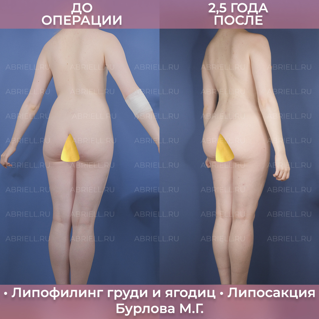 -1-2