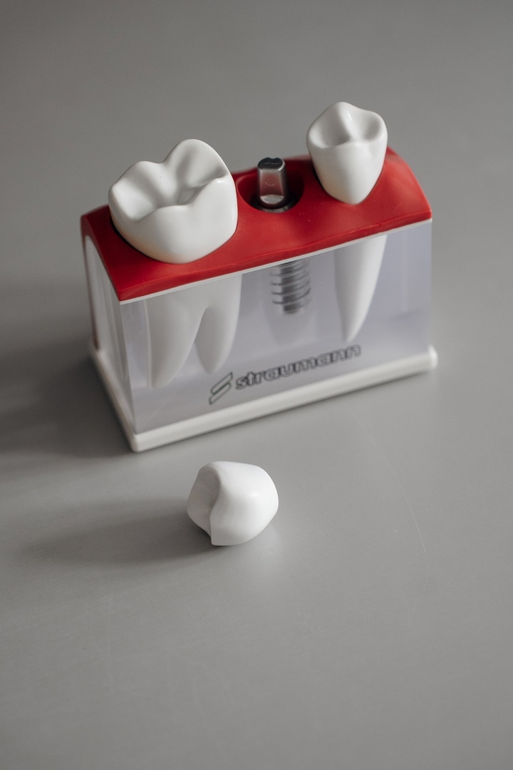 Протезирование в персональной стоматологической клинике Only Dent в центре Краснодара