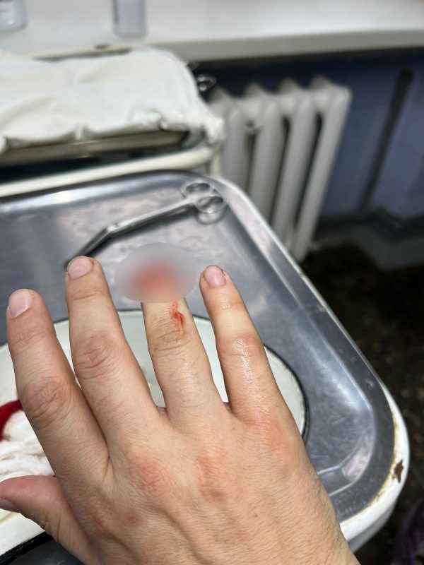    В Бюро судмедэкспертизы назвали такую травму "легким вредом здоровью".