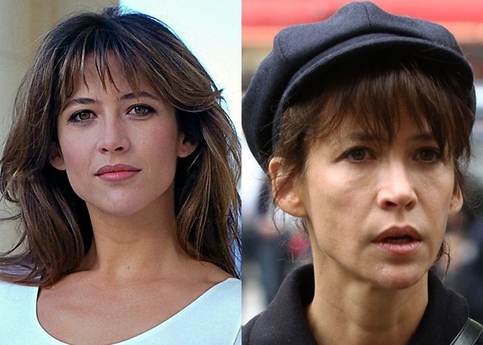 Усталый тип старения лица