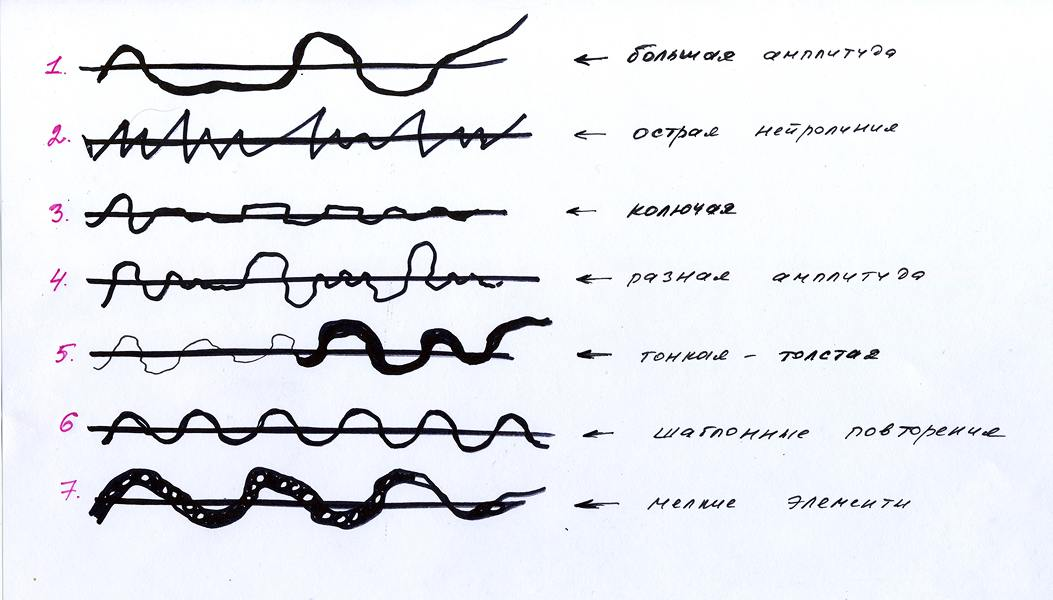 Нейрографическая линия. Ошибки. 