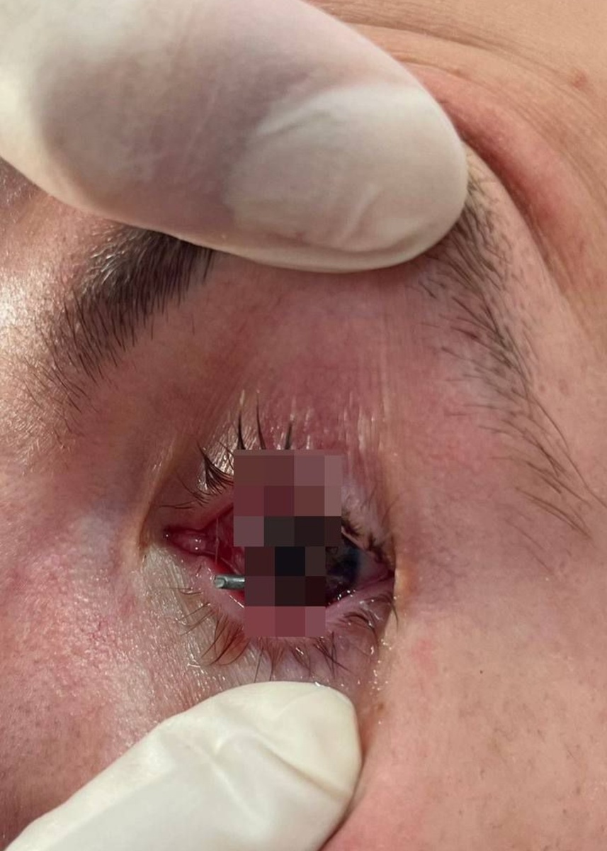 18+ Фото: Айрат Рахматуллин, телеграм