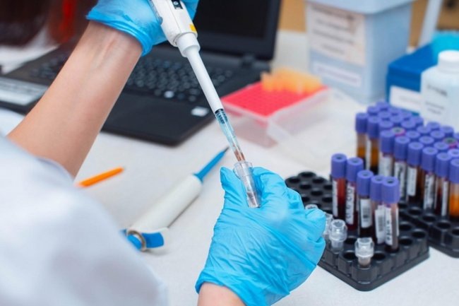    Ученые смогли оживить вымершего козла, который исчез 25 лет назад, на семь минут