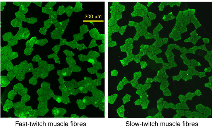 Микросрез мышечных волокон разного типа (быстросокращающихся и медленносокращающихся). Источник: Эдуард Генерозов