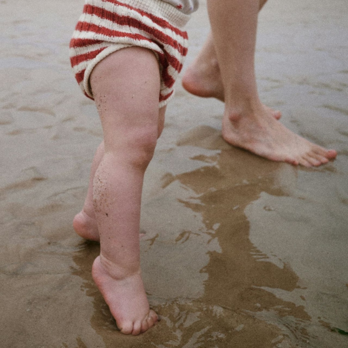 Периодическая ходьба на носках - это вид походки, при котором стопы не соприкасаются с полом. Чаще всего у детей до трех лет она связана с их эмоциональным состоянием, а также с узнаванием возможностей своего тела