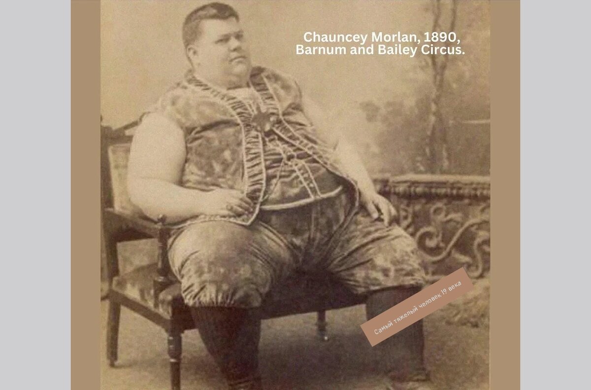 Яндекс-картинки. В 1890 г. Ченси Морлан  выступал в цирке уродов из-за лишнего веса. Современники платили деньги, чтобы посмотреть на мужчину, ведь редко встречали настолько толстых людей в жизни. Это было в 19 веке. Сейчас такие люди стали обычными во многих городах мира.