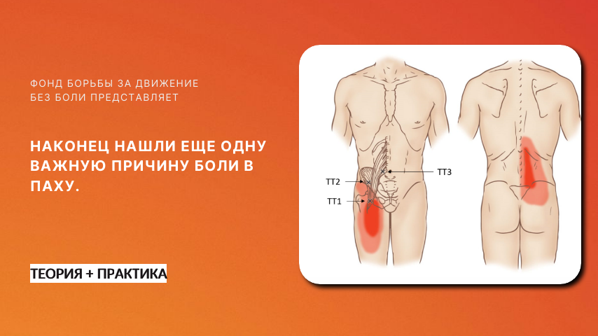 Боль в пояснице, ягодицах, сильная боль в паху. Не артроз, не сустав.
