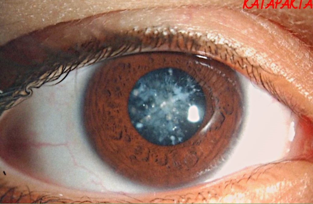 После операции