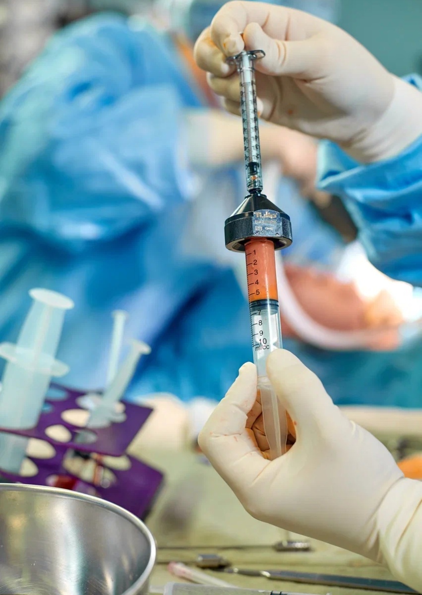 Липофилинг 