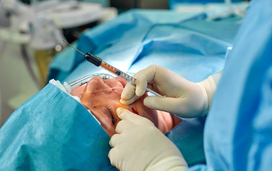 Блефаропластика 