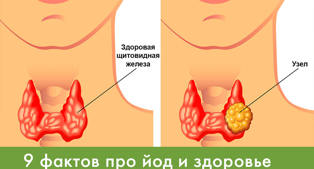 9 фактов про йод и здоровье щитовидки