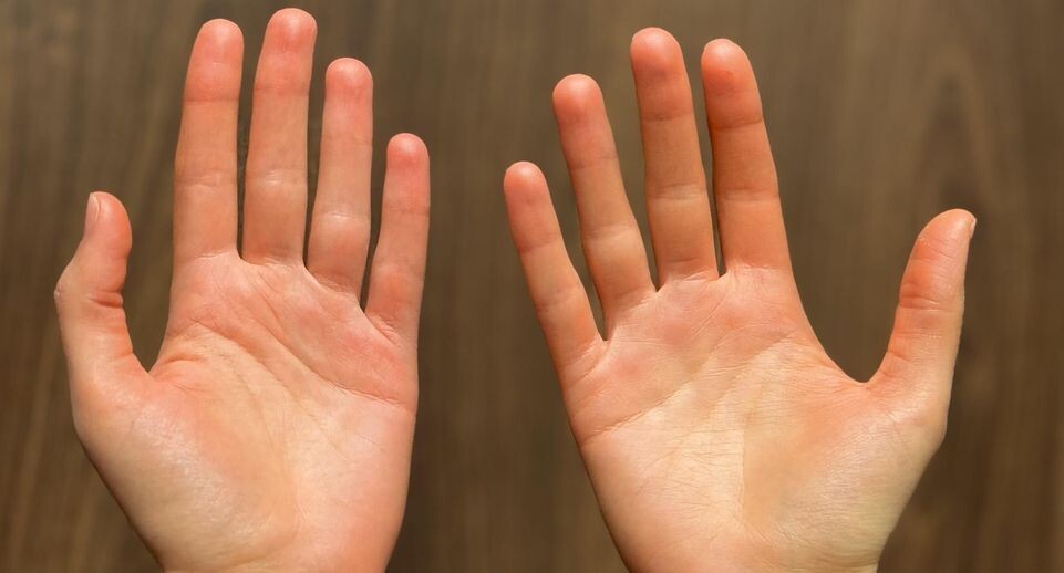    Пресс-секретарь ГБУЗ МО «МОККВД»