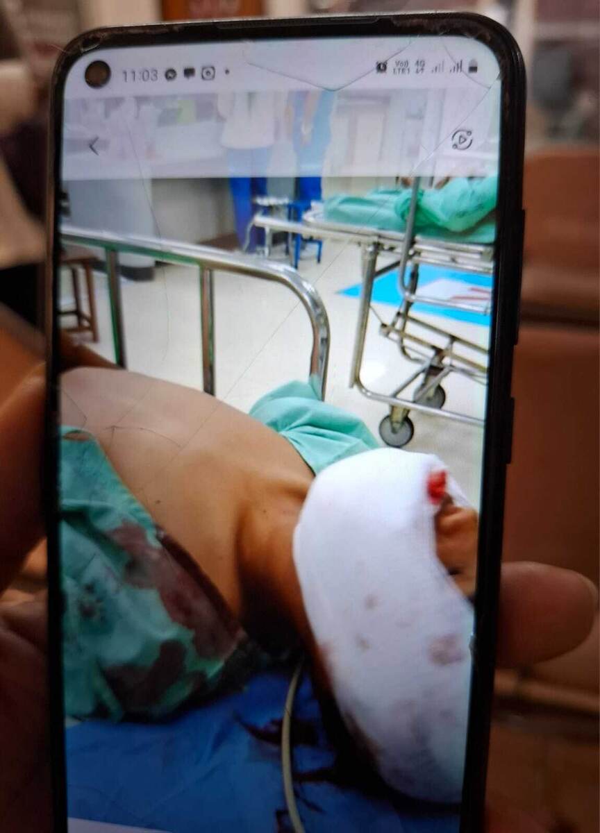 Старший мальчик в приемном покое с ЧМТ. 