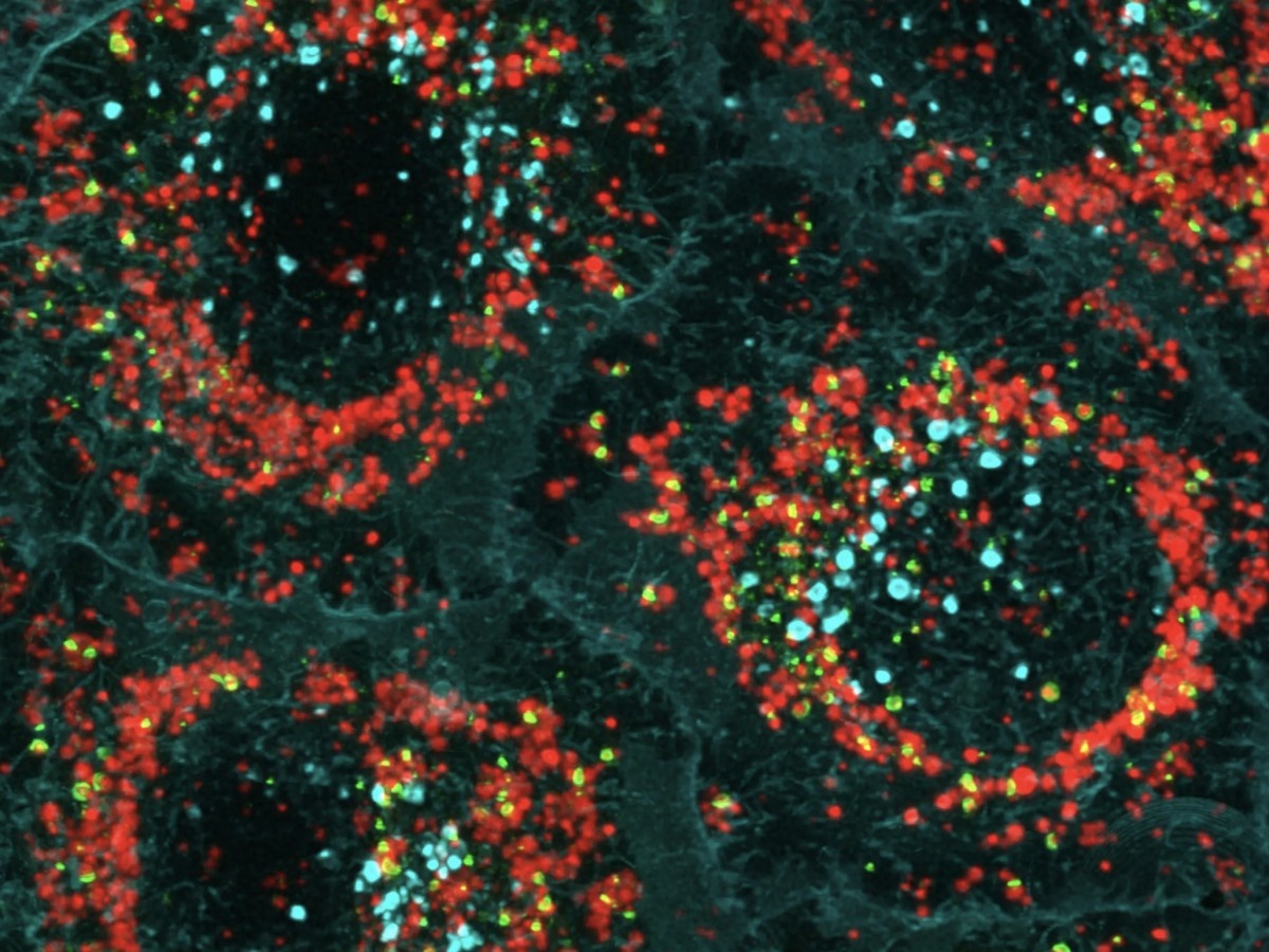    Получен снимок белка, ответственного за болезнь Паркинсона