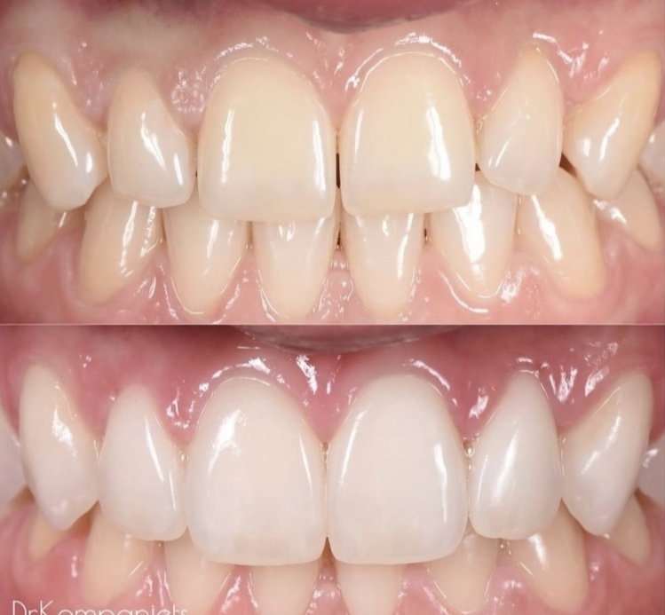 Сомнительно по показаниям