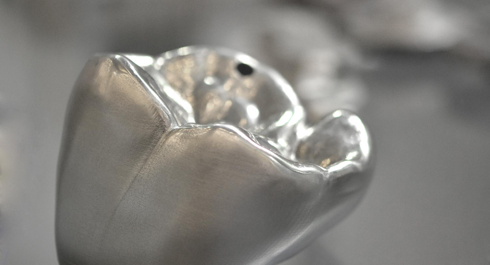 Диабет и металлические коронки во рту