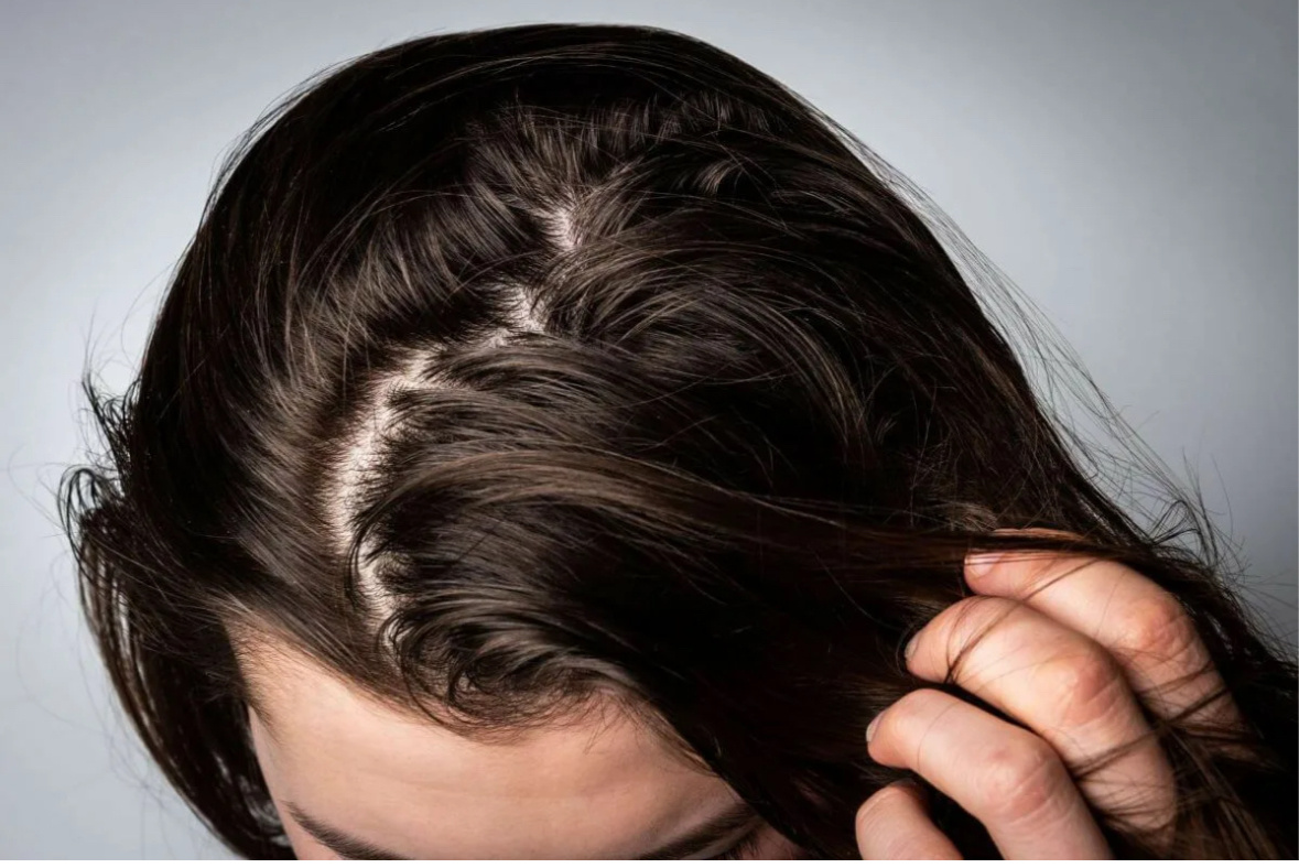 Жирность волос мучала меня давно. Началось все после рождения ребенка.