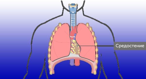 Схематичное расположение средостения в грудной клетке 