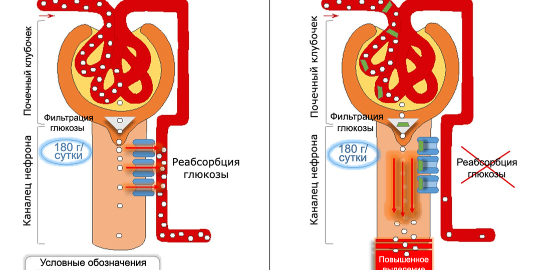 SGLT2-ингибиторы: лечат не только диабет, но и сердце, почки, мозг