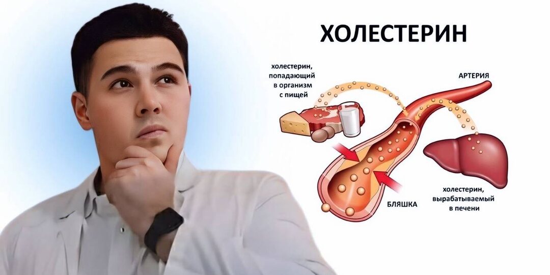 Как снизить холестерин без дорогих лекарств: 5 простых способов