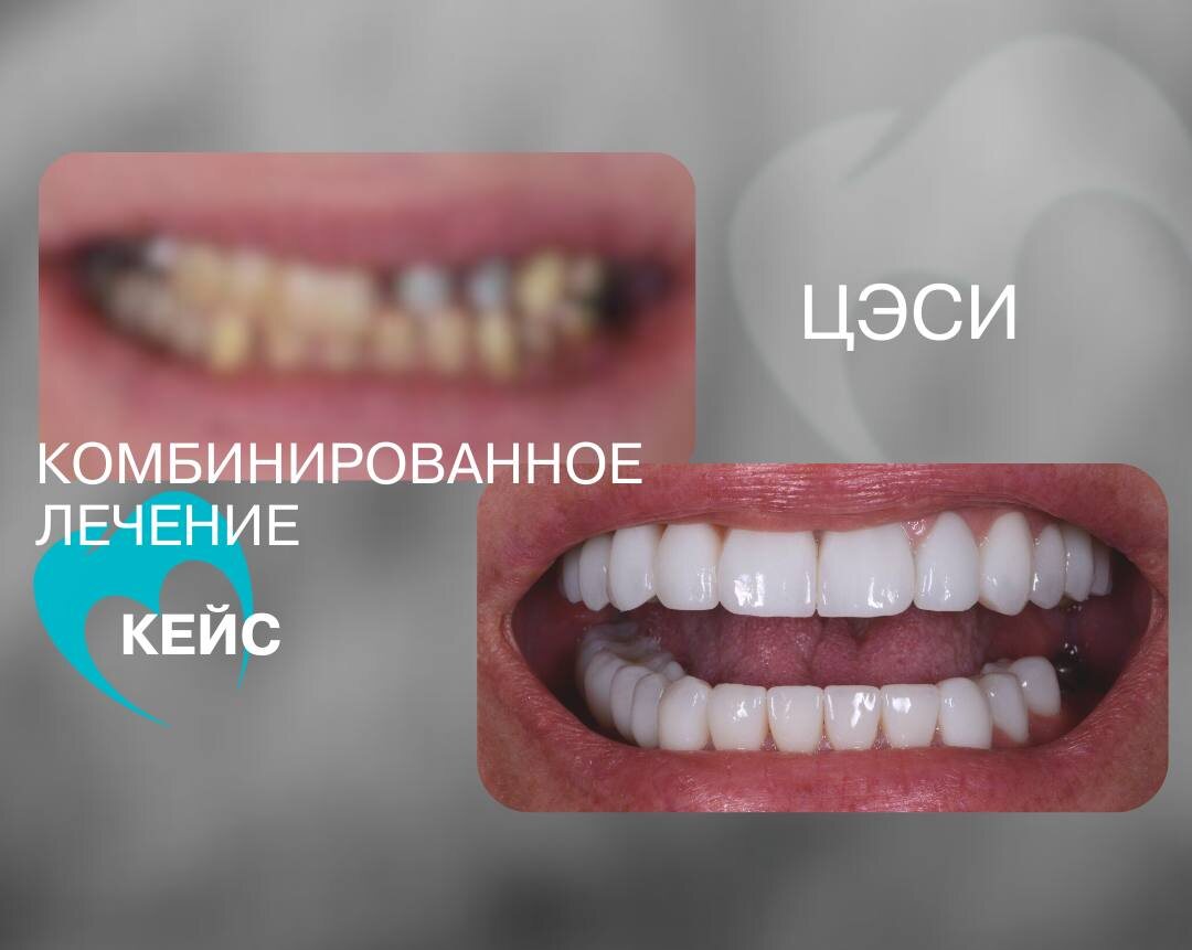 Лечение и имплантация зубов на Камчатке