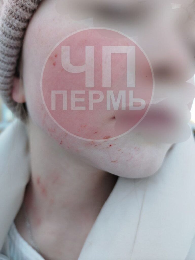    Фото: ЧП Пермь / ТГ Полина Анкушина