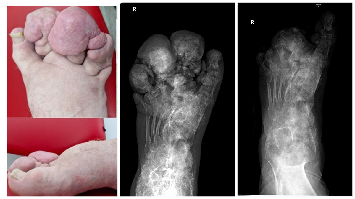 До и после операции 