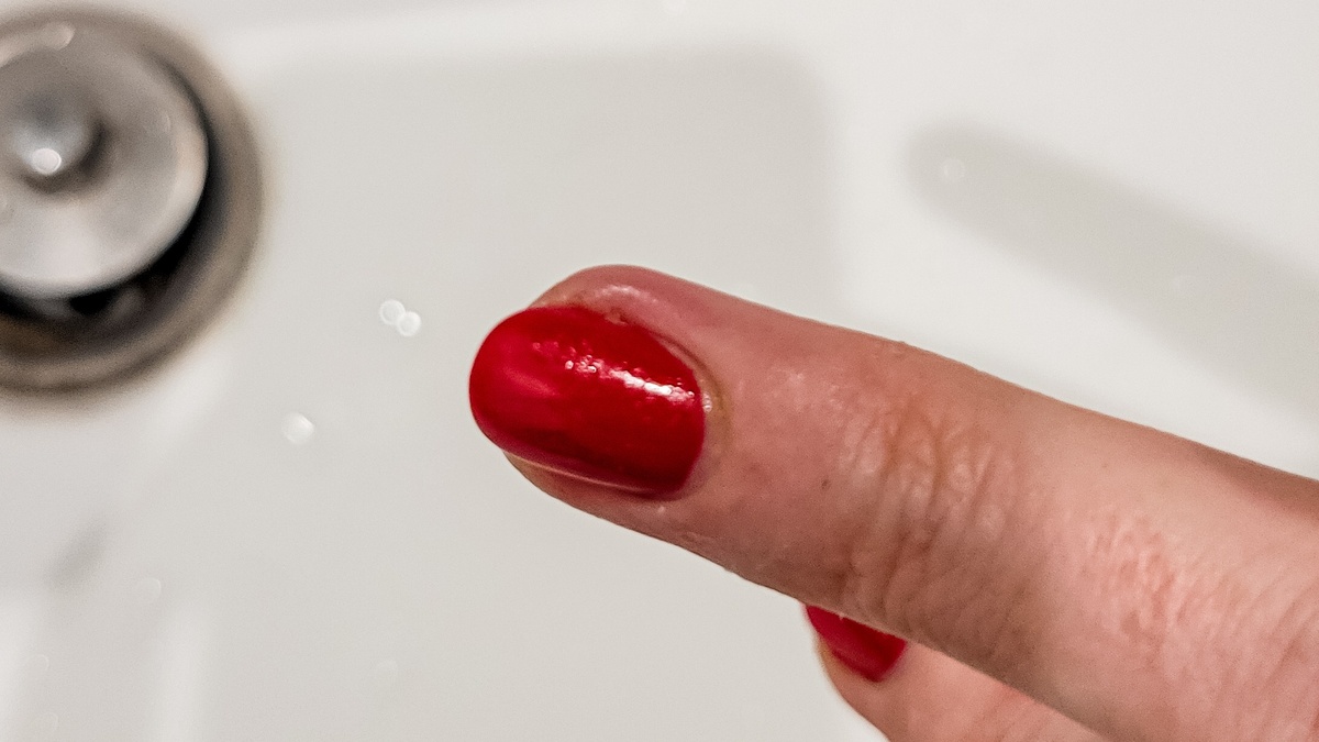 Вот так выглядел мой воспаленный палец. С правой стороны видно, как он опух и покраснел.