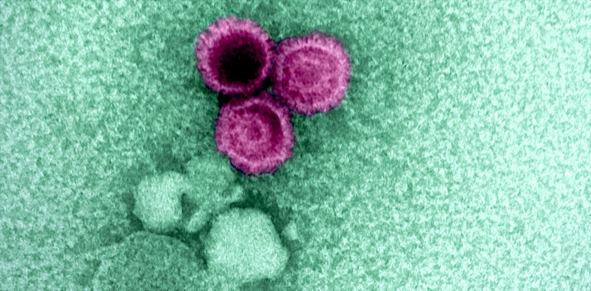 Частицы вируса Эпштейна-Барр (розовым цветом). © CC BY 2.0/NIAID
