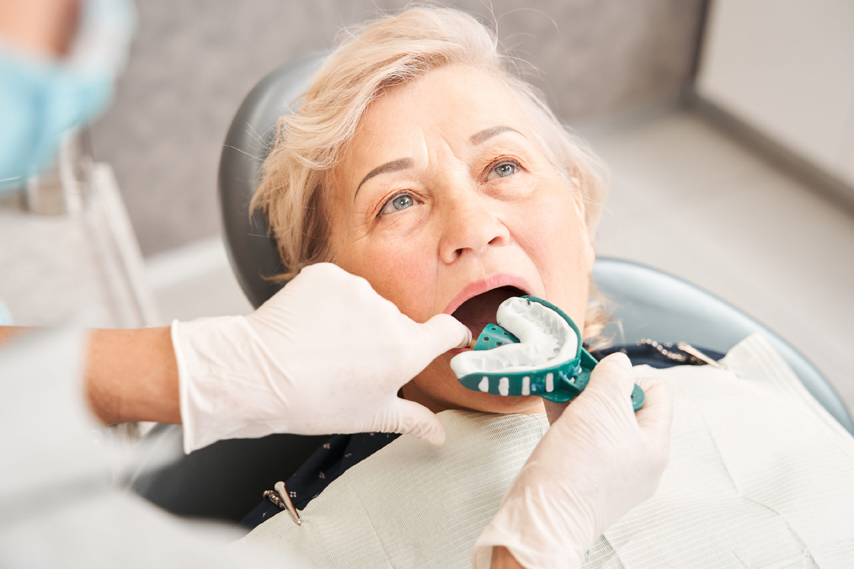 Снятие индивидуального слепка