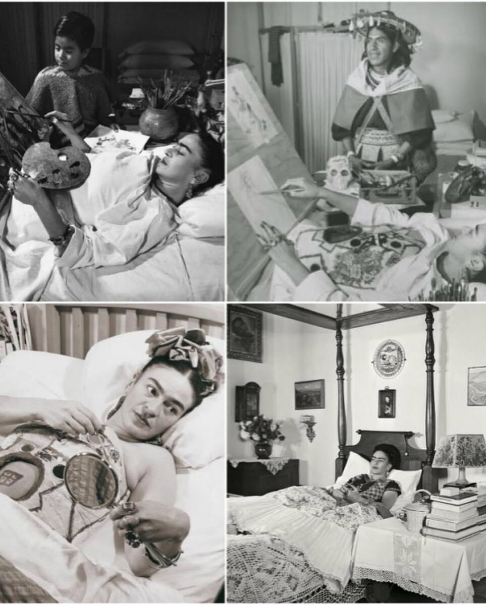 Фрида Кало после аварии.