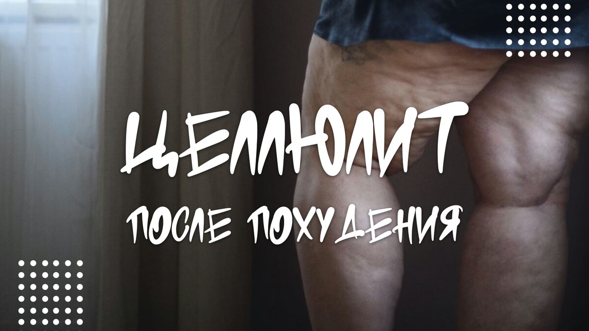 Целлюлит при похудении