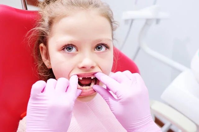    Нужно ли удалять молочные зубы, если они долго не выпадают?