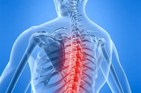 Остеохондроз грудного отдела позвоночника: причины, симптомы, лечение и профилактика
