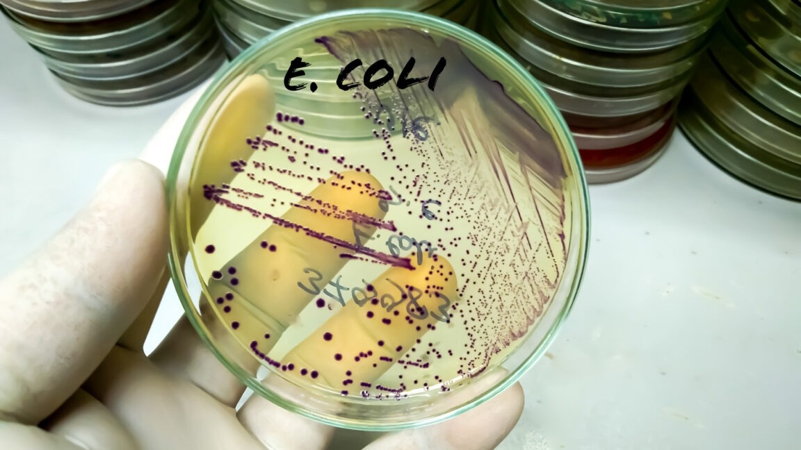 Культуры бактерий Escherichia coli (E. coli) на чашке Петри.    
 Источник: Md Ariful Islam  📷

