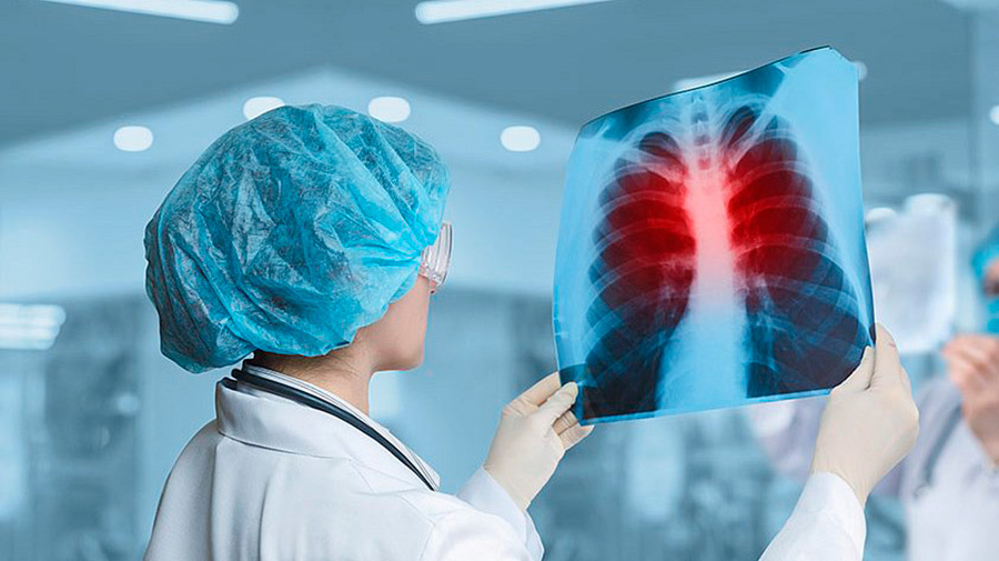     Туберкулез: как обезопасить себя от болезни