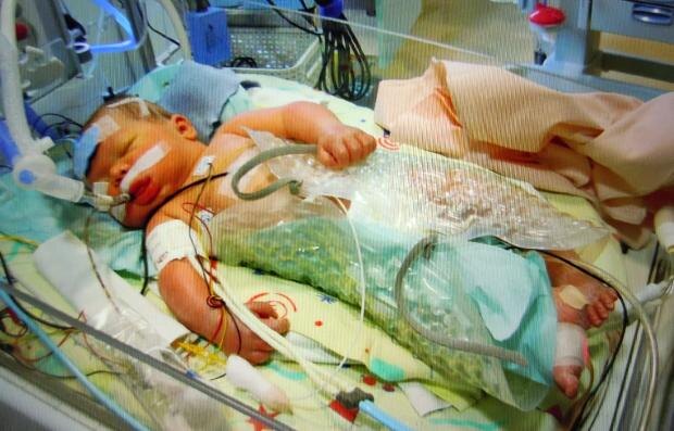 Ребенок в условиях аппаратной гипотермии (охлаждения до температуры 33,5 оС)