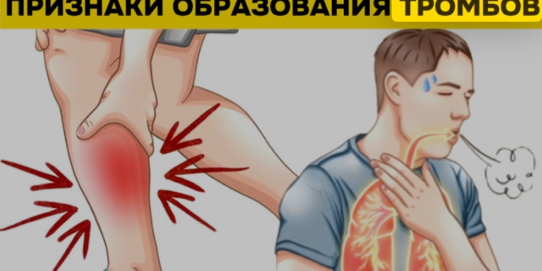 Тихие сигналы беды: 8 признаков, что в вашем организме может скрываться тромб (и почему их нельзя игнорировать)