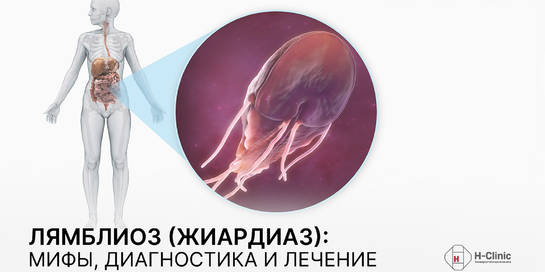 Лямблиоз (жиардиаз): мифы, диагностика и лечение