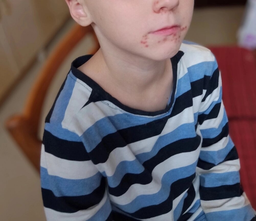    Туристы сообщили, что у детей появляется сыпь. Фото:  АиФ/ Екатерина Горбунова