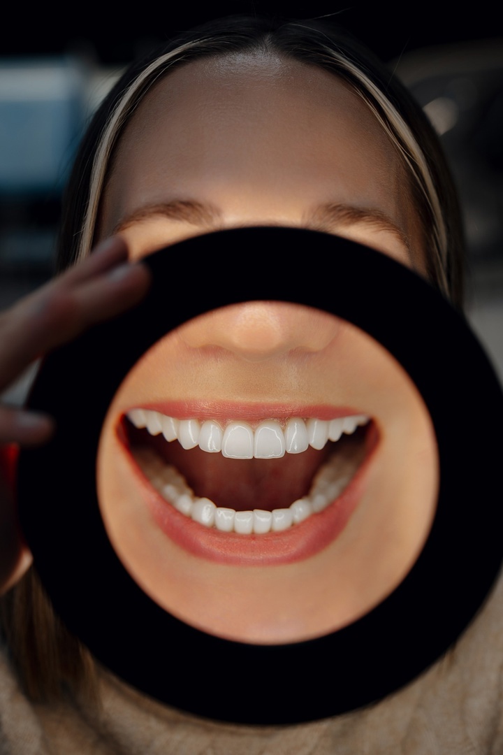 Установка брекетов в Краснодаре в персональной стоматологической клинике Only Dent