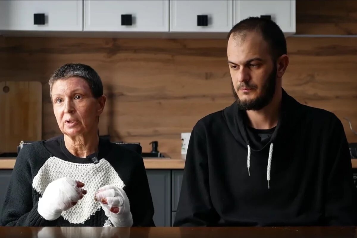    Татьяне поставили диагноз «ожоговая болезнь».