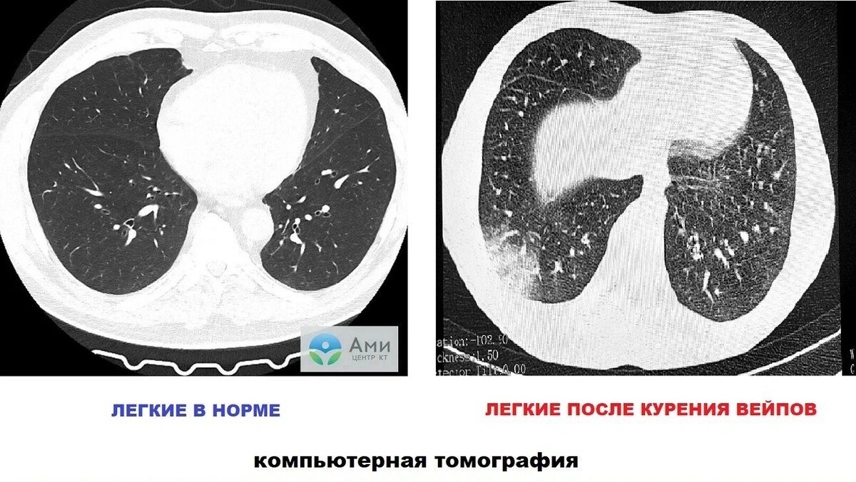    Фото: t.me/rpntomsk