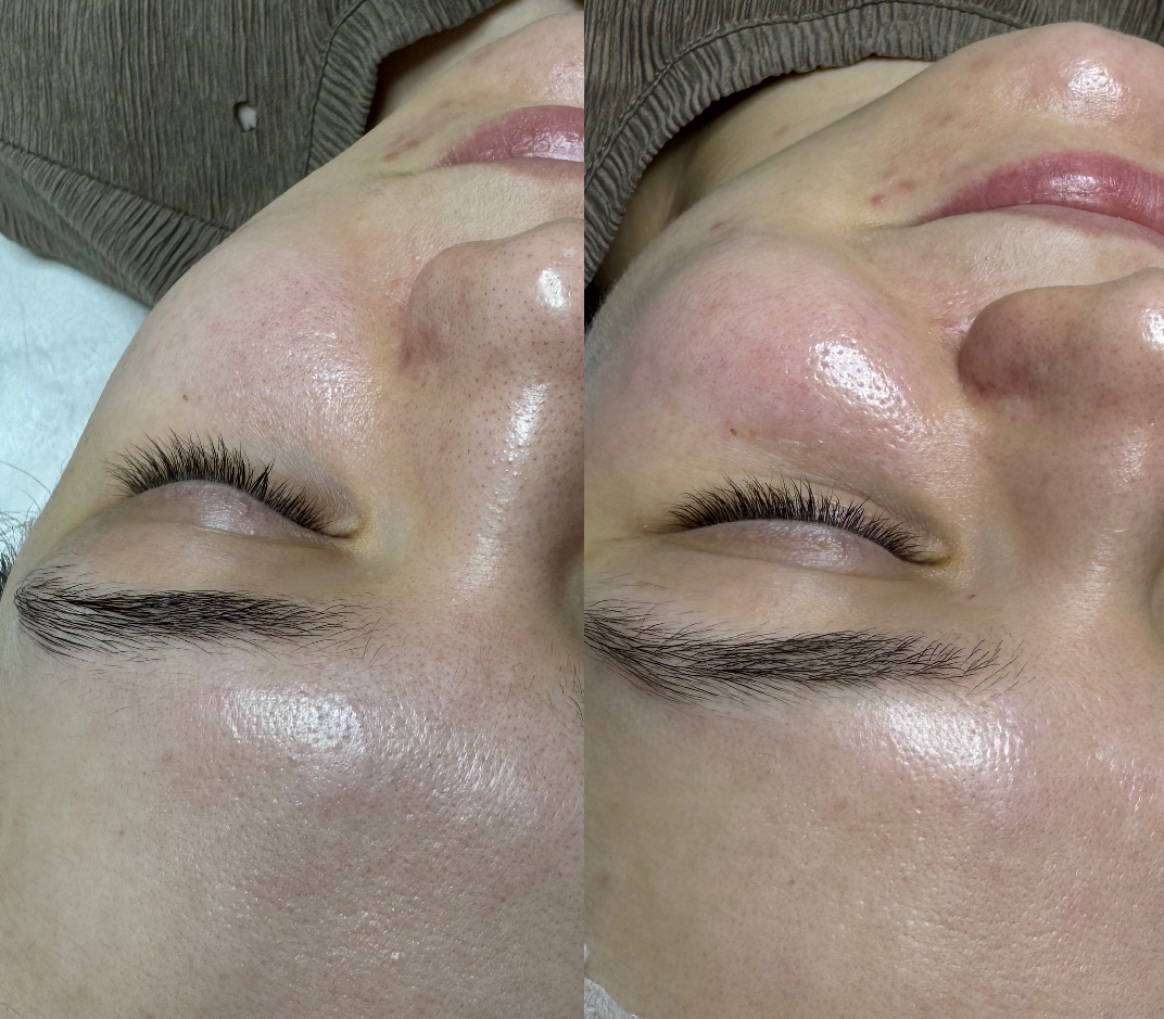 Чистак лица 3 в 1