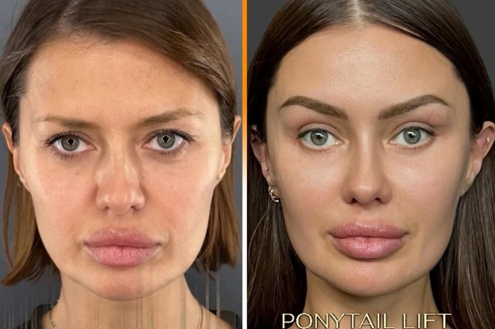 Виктория Боня